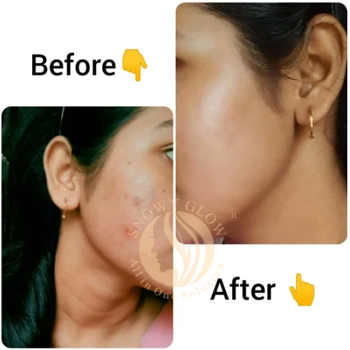 Night Repair Brightening Cream Regular (Effects within 1 Week)