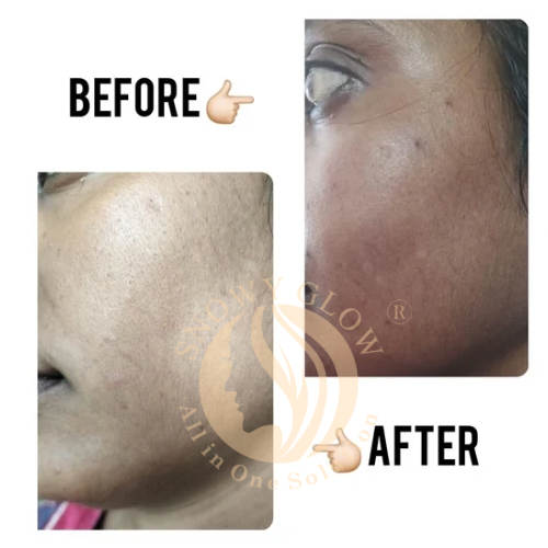 Night Repair Brightening Cream Regular (Effects within 1 Week)